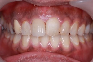 2507303
